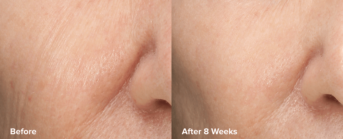 Skin Perfecting 6% Mandelic + 2% Lactic Acid AHA Liquid Exfoliant