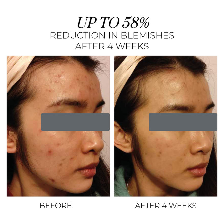 Violet Water Hydra-Gel - Clarifying Daily Moisturiser