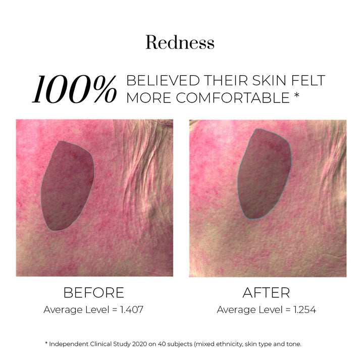 Isotonic Hydra-Serum - Εντατικός Βιο-Μιμητικός Ορός Ενυδάτωσης