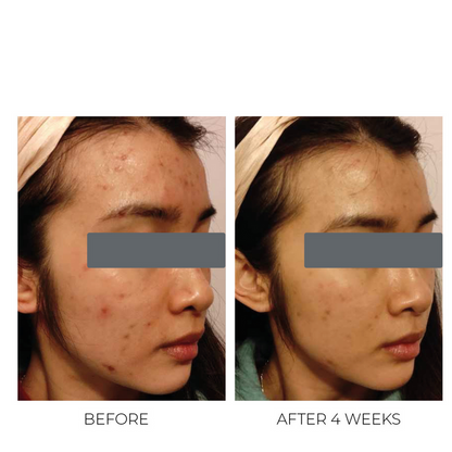 Violet Water Treatment Tonic - 2% BHA Θεραπεία Αποσαφήνισης