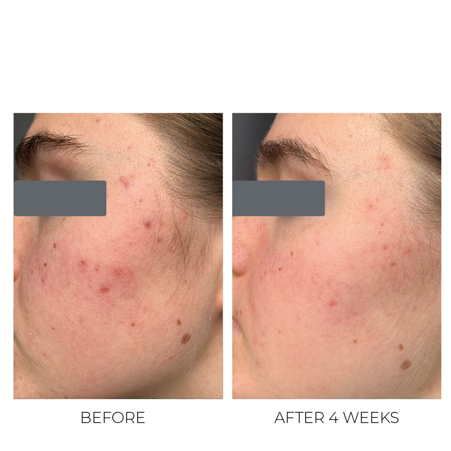Violet Water Treatment Tonic - 2% BHA Θεραπεία Αποσαφήνισης