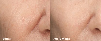 Skin Perfecting 6% Mandelic + 2% Lactic Acid AHA Liquid Exfoliant