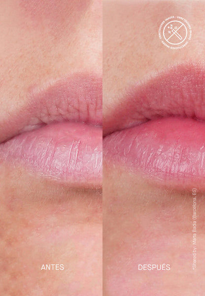 🎁 Overnight Soft + Smooth Lip Treatment (100% off)