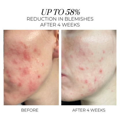Violet Water Treatment Tonic - 2% BHA Θεραπεία Αποσαφήνισης