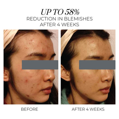 Violet Water Hydra-Gel - Clarifying Daily Moisturiser
